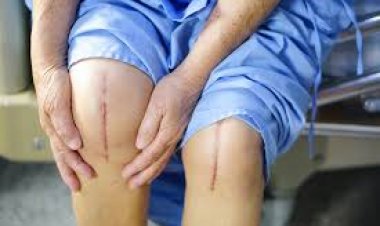 Post Surgical Pain: Causes and Management