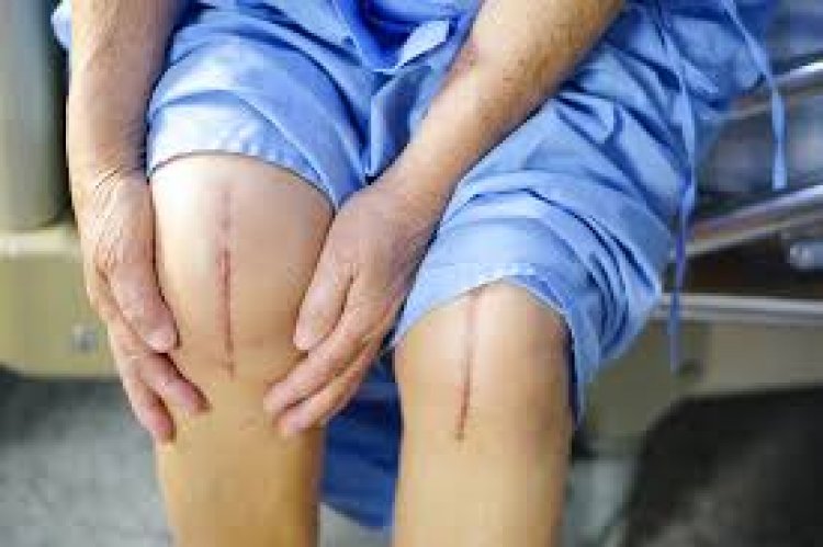Post Surgical Pain: Causes and Management