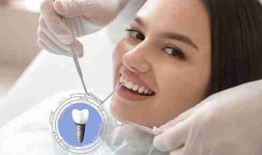 Revived Subperiosteal Implants Offer Hope in Extreme Bone Loss