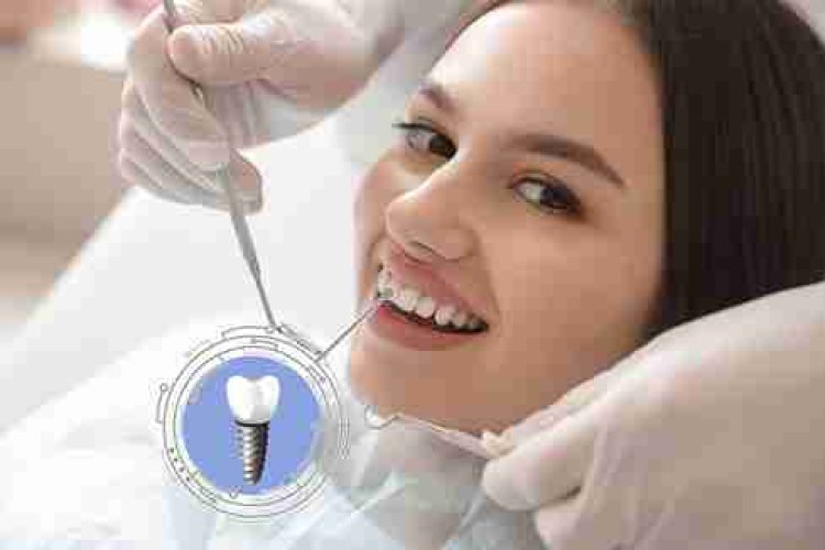 Revived Subperiosteal Implants Offer Hope in Extreme Bone Loss